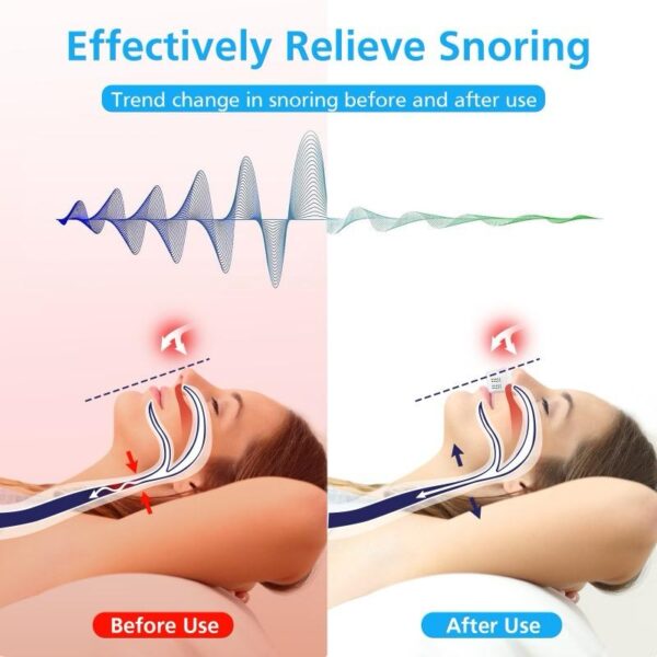 دستگاه ضد خروپف مدل CPAP کوچک