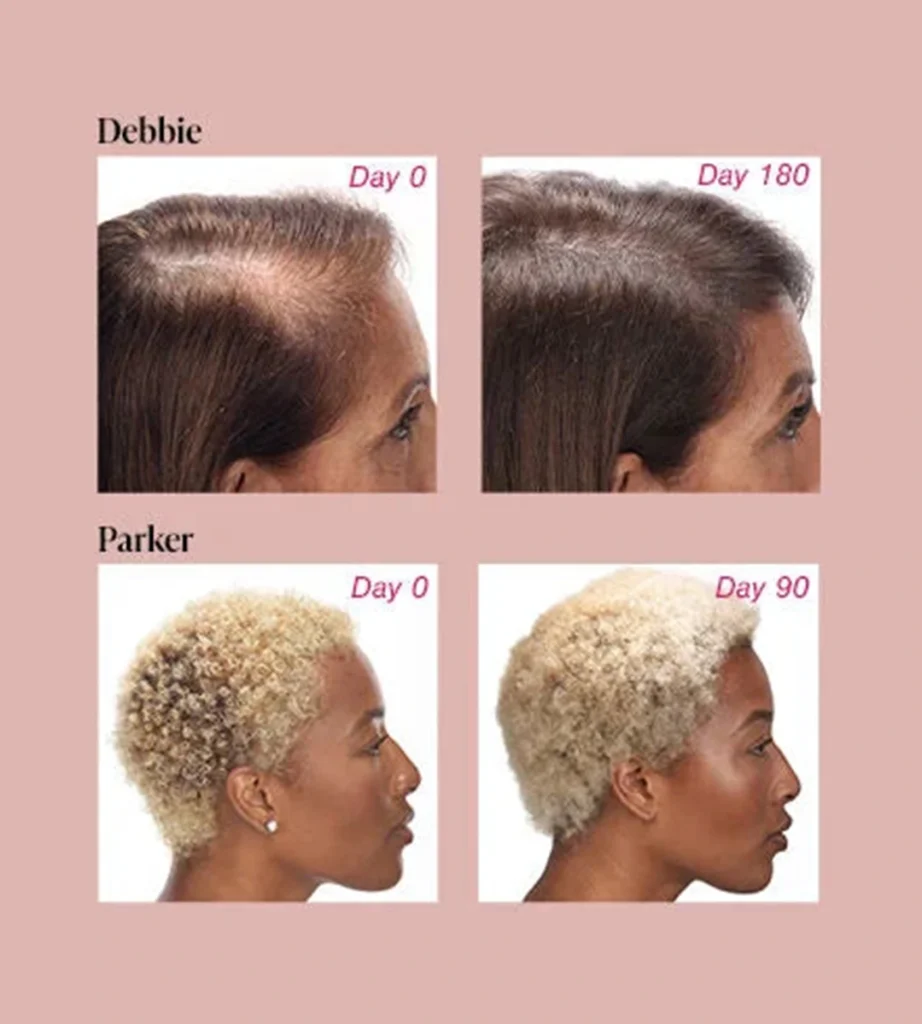 مکمل تقویت مو ویويسکال  Viviscal Healthy Hair Vitamin