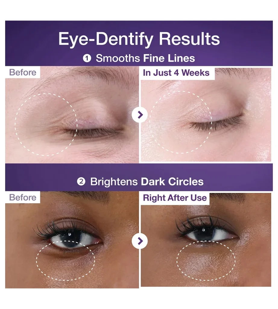کرم دور چشم با اثر ضدچروک لیفتینگ و رتینول نامبوزین Numbuzin - No.9 NAD Retinol Volumetox Eye Cream